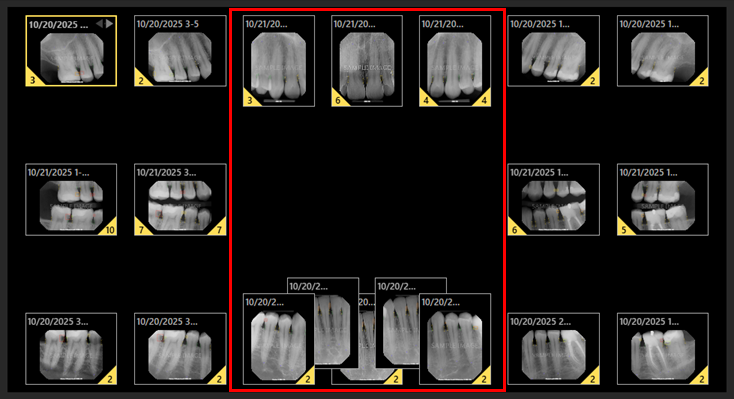 A close-up of a x-ray

AI-generated content may be incorrect.