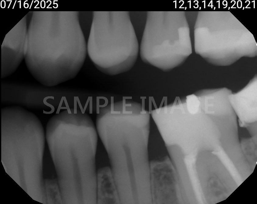 A close-up of teeth
AI-generated content may be incorrect.