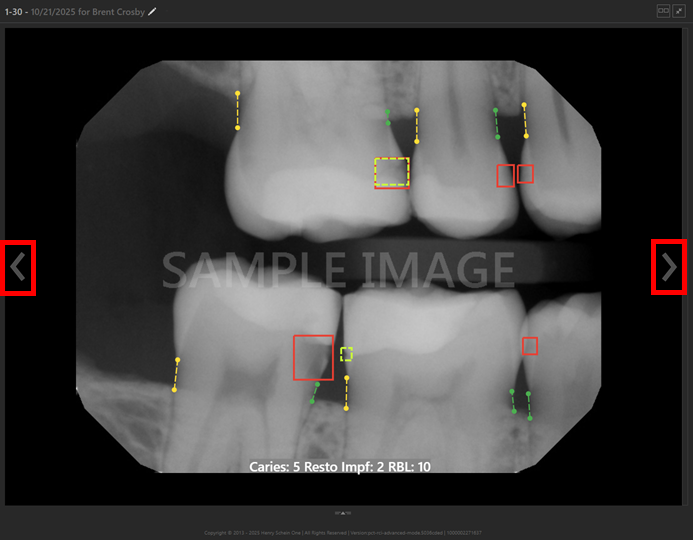 A close-up of teeth
AI-generated content may be incorrect.
