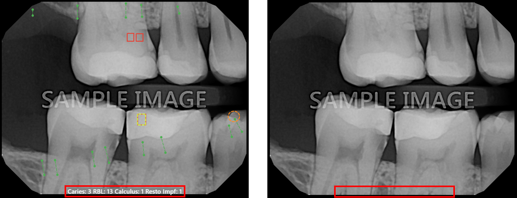 A close-up of teeth

Description automatically generated