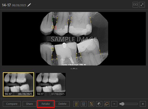 A screenshot of a dental x-ray
AI-generated content may be incorrect.