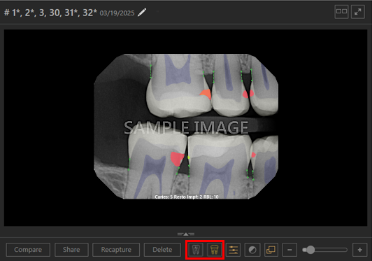 A screenshot of a dental x-ray

AI-generated content may be incorrect.
