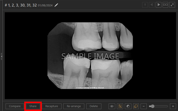 A screenshot of a dental x-ray

Description automatically generated